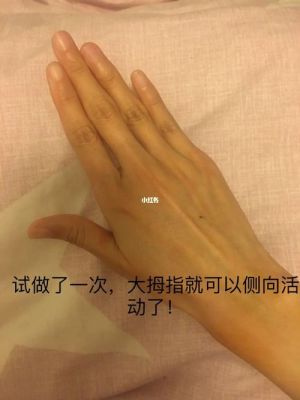 怎么锻炼大拇指伸屈？-无法触碰的掌心新手